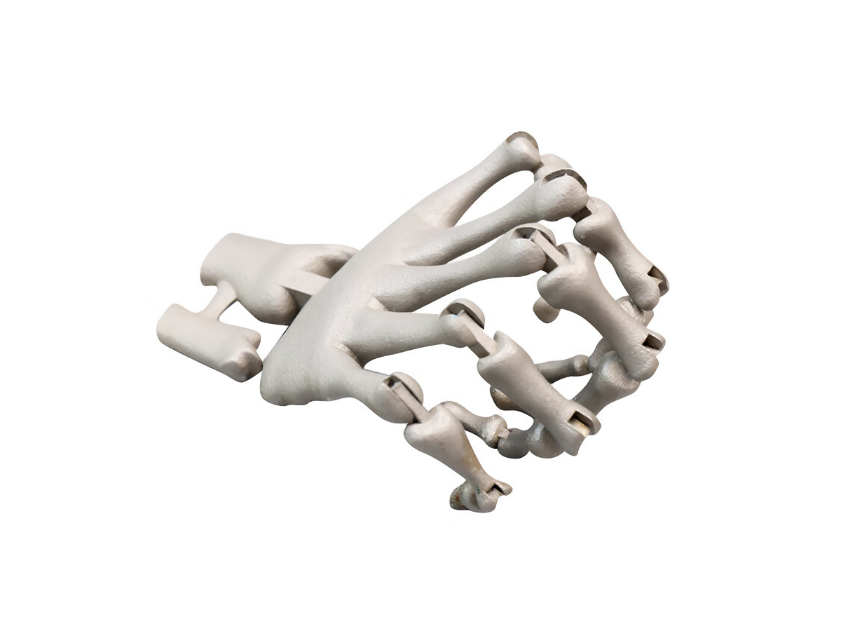 High-Precision Titanium 3D Printing: Custom Parts for Medical Prosthesis Application